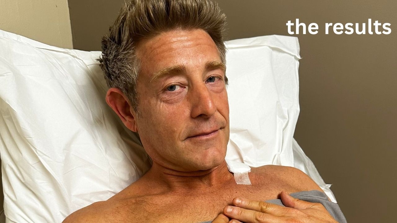 Finding Out If I Have Skin Cancer
