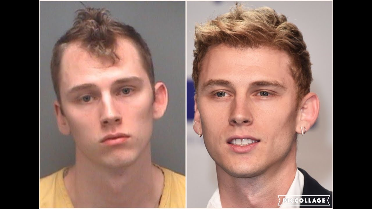 Machine Gun Kelly - Hair Transplant