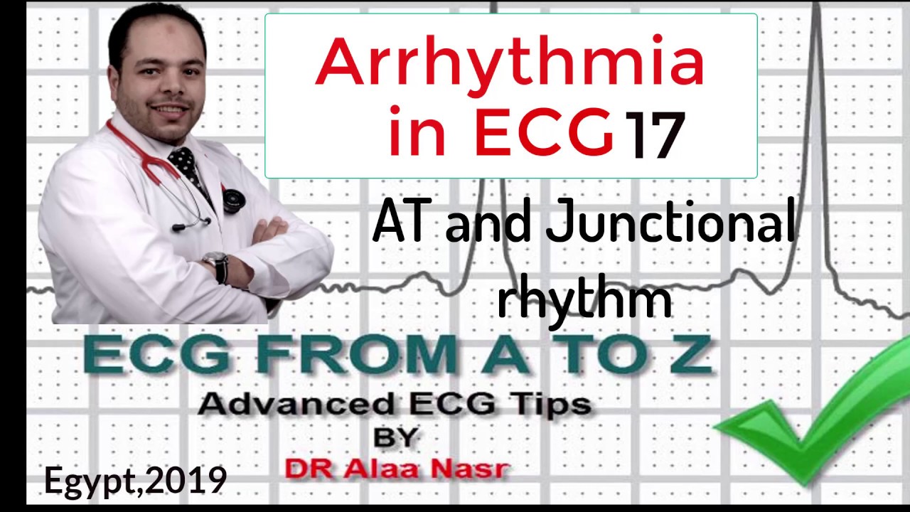 ECG from A to Z, intermediate level, Arrhythmia 17, Dr Alaa Nasr, 2019