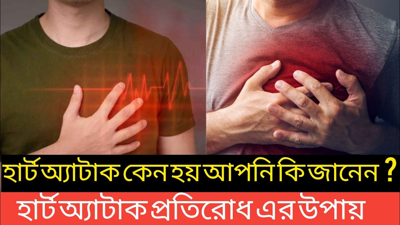 হার্ট অ্যাটাক কেন হয় আপনি কি জানেন  ? হার্ট অ্যাটাক প্রতিরোধে আপনার করনীয় কি?