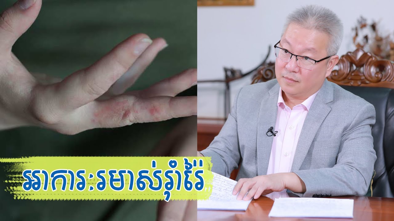 យល់ដឹងពីអាការៈដែលបណ្តាលឱ្យកើតជំងឺរមាស់រ៉ាំរ៉ៃ​