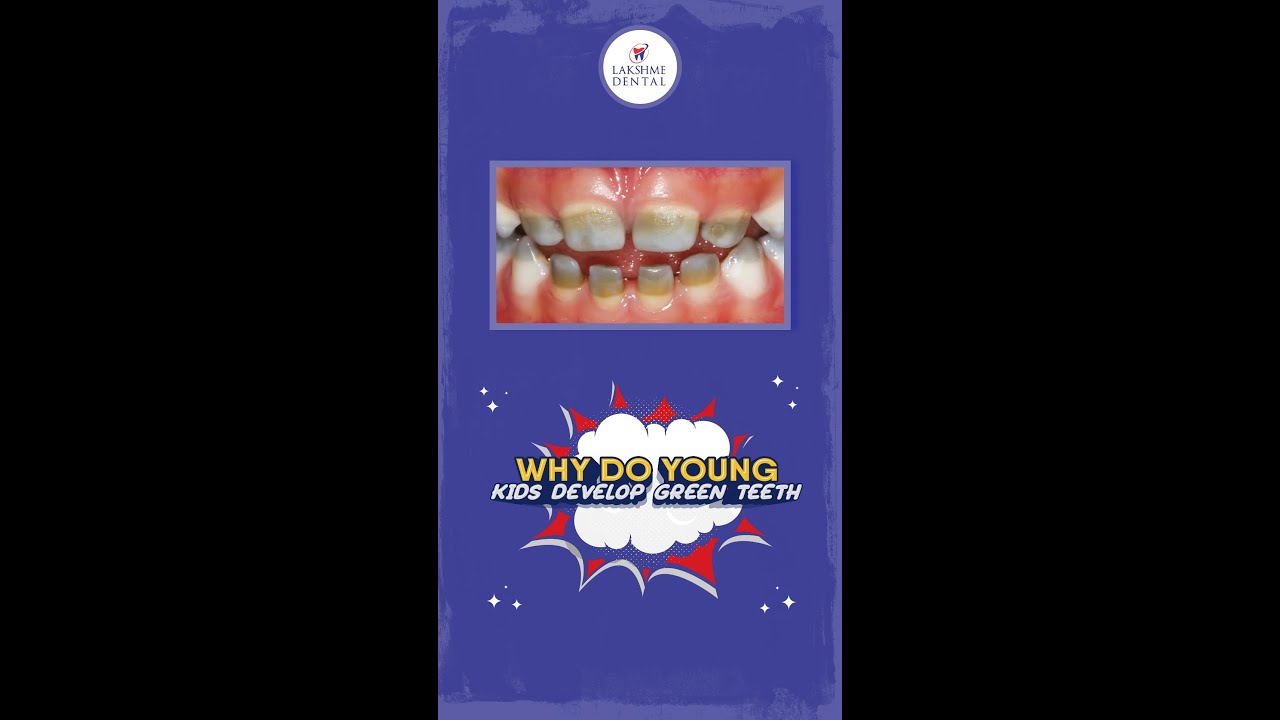 Why do young kids develop green teeth | Green stained teeth | Tooth discoloration