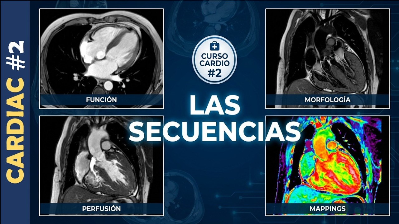 Cardio #2. Programación de la Resonancia Magnética Cardíaca. Funcional, Perfusión, Viabilidad, Mappi