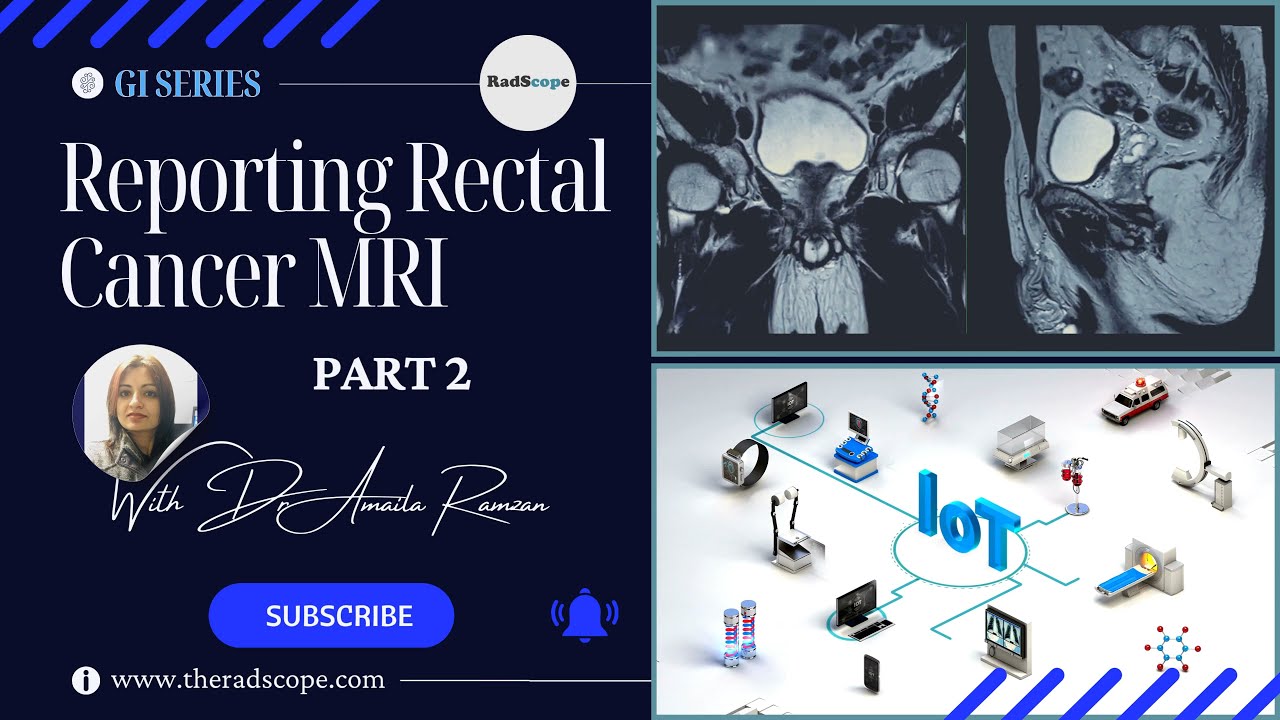 Staging and Reporting Rectal Cancer Part 2