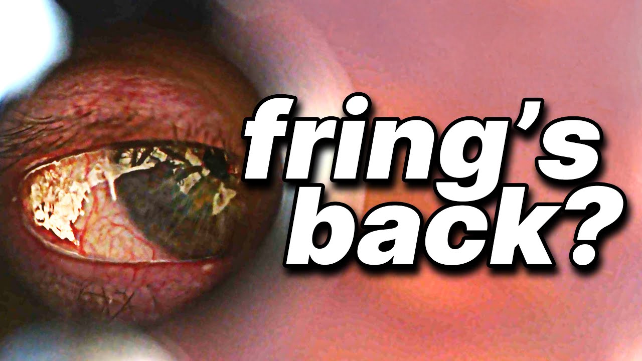 Better Call Saul: 70 Hidden Details in Klick (S2E10)