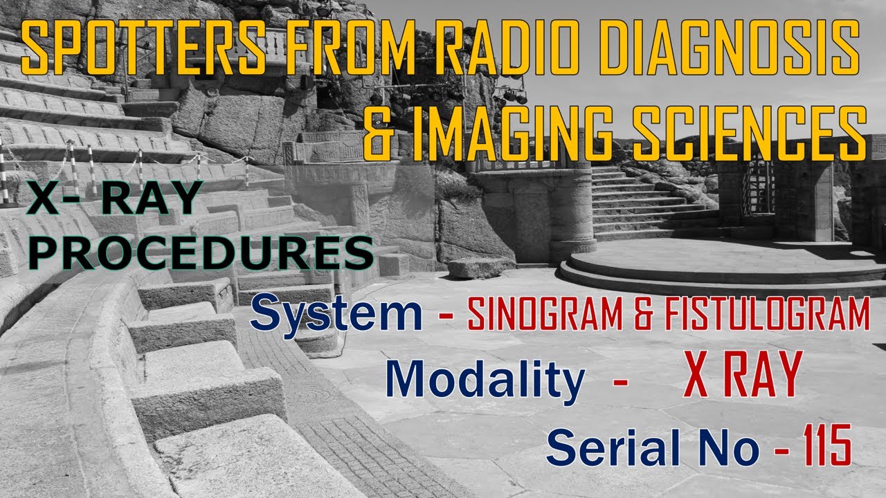 SPOTTERS FROM X-RAY PROCEDURES (SINOGRAM & FISTULOGRAM - 115) BY DR . ANIL JOSHI.
