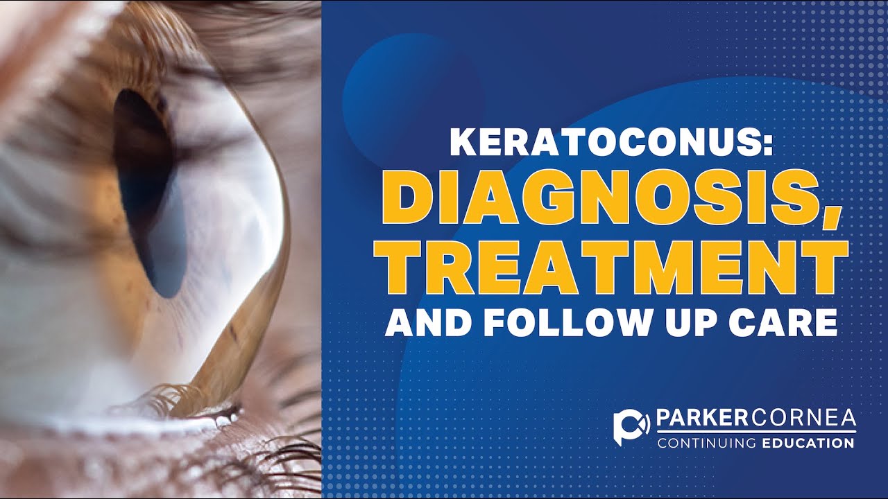 Keratoconus: Diagnosis, Treatment and Follow-up Care