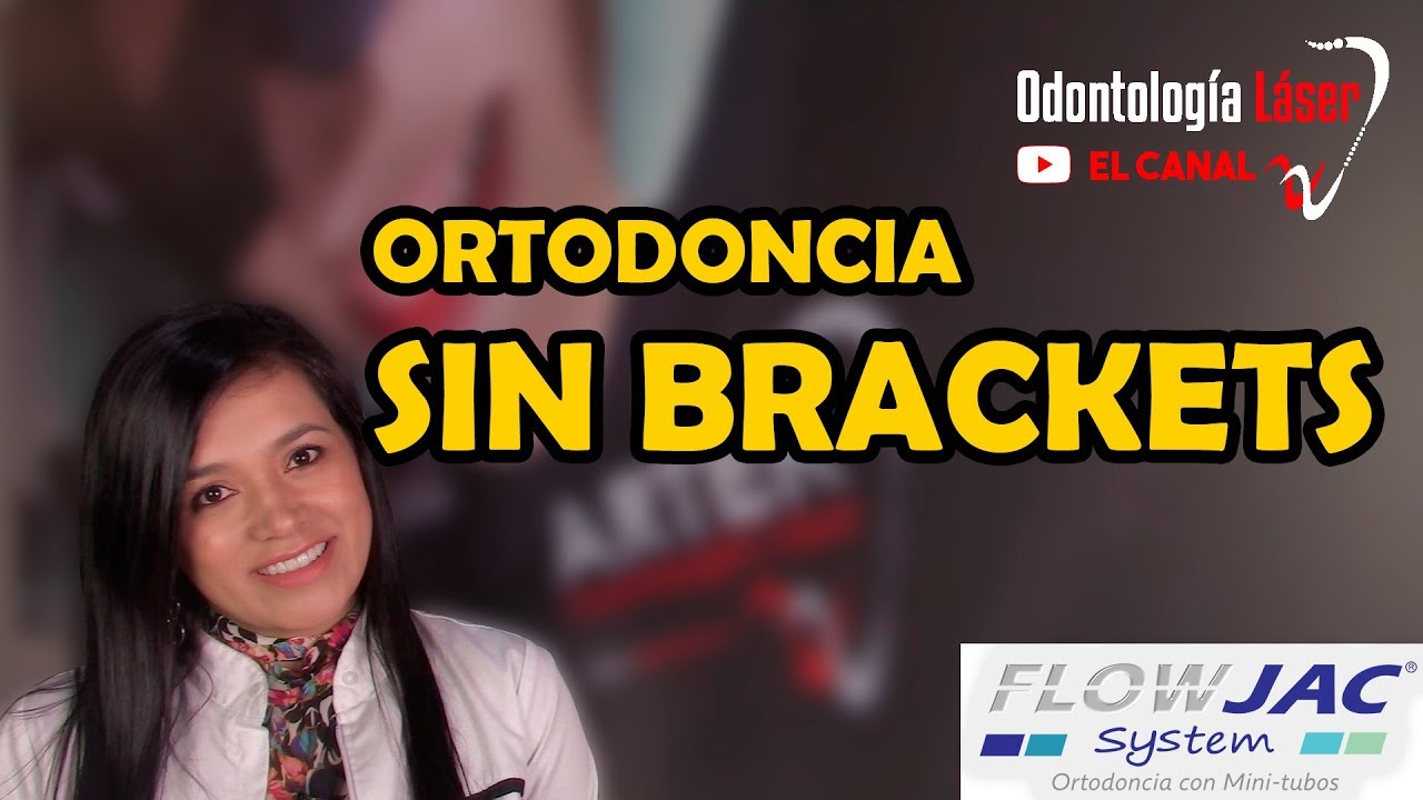 Ortodoncia sin brackets Flow Jac - Odontología Láser