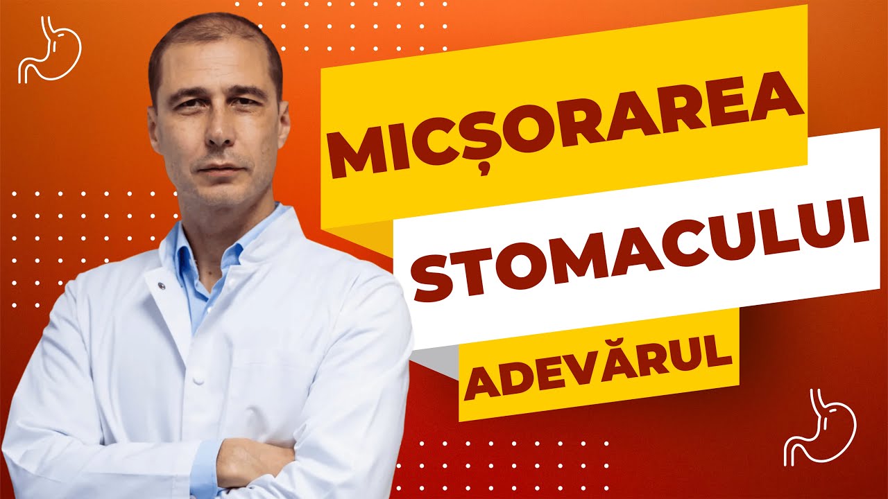 Micșorarea de stomac (gastric sleeve): explicații clare și realiste de la un medic chirurg