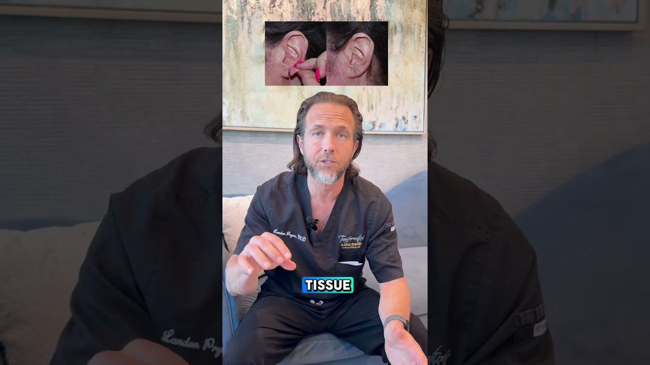 Dr. Landon Pryor Explains Earlobe Repair: Solutions for Torn or Stretched Ears | PryorHealth