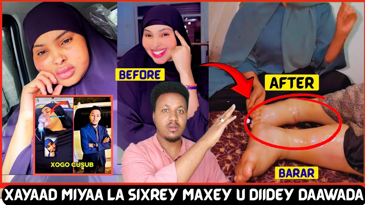 Xayaad Qurux Ayaa Diidey In La Daaweeyo Xaaladeena Waxeey Mareysaa Meel Halis Ah Iyo Arin Mucjiso Ah