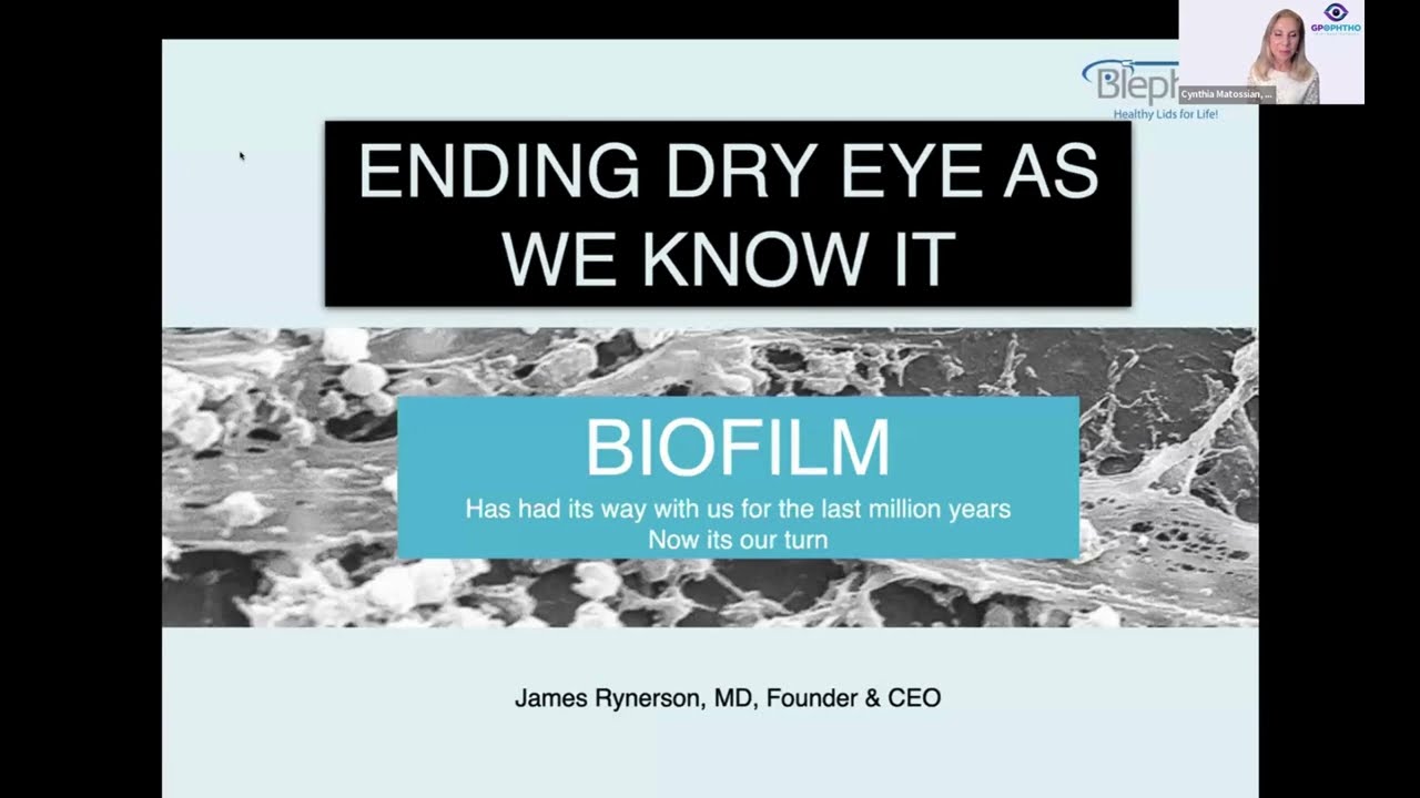 BlephEx & Optivize Webinar