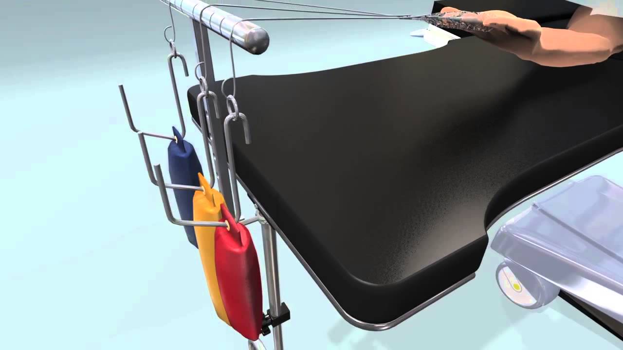 Traction System for Hand Surgery Tables, complete with Finger Traps and Weights