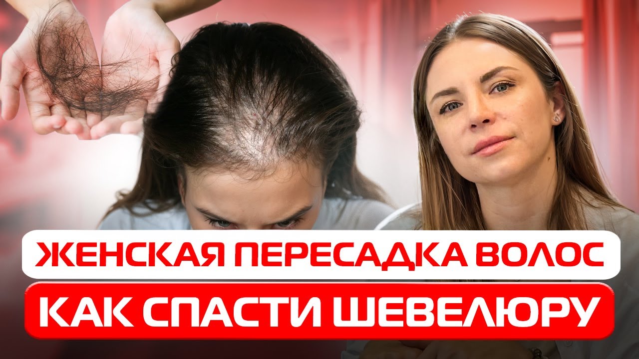Как вернуть густые волосы: Всё о женской пересадке волос!