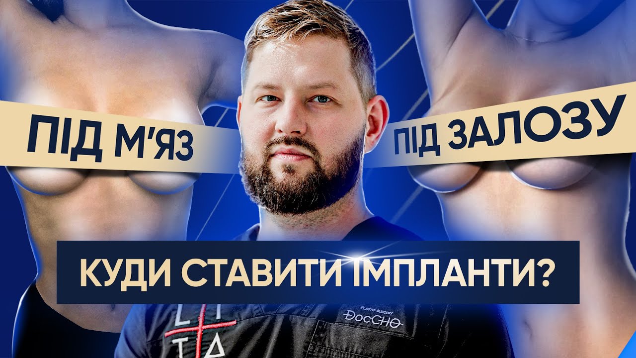 Під м'яз чи залозу ЯК краще?! | РУХ імпланта, УСКЛАДНЕННЯ та інше.