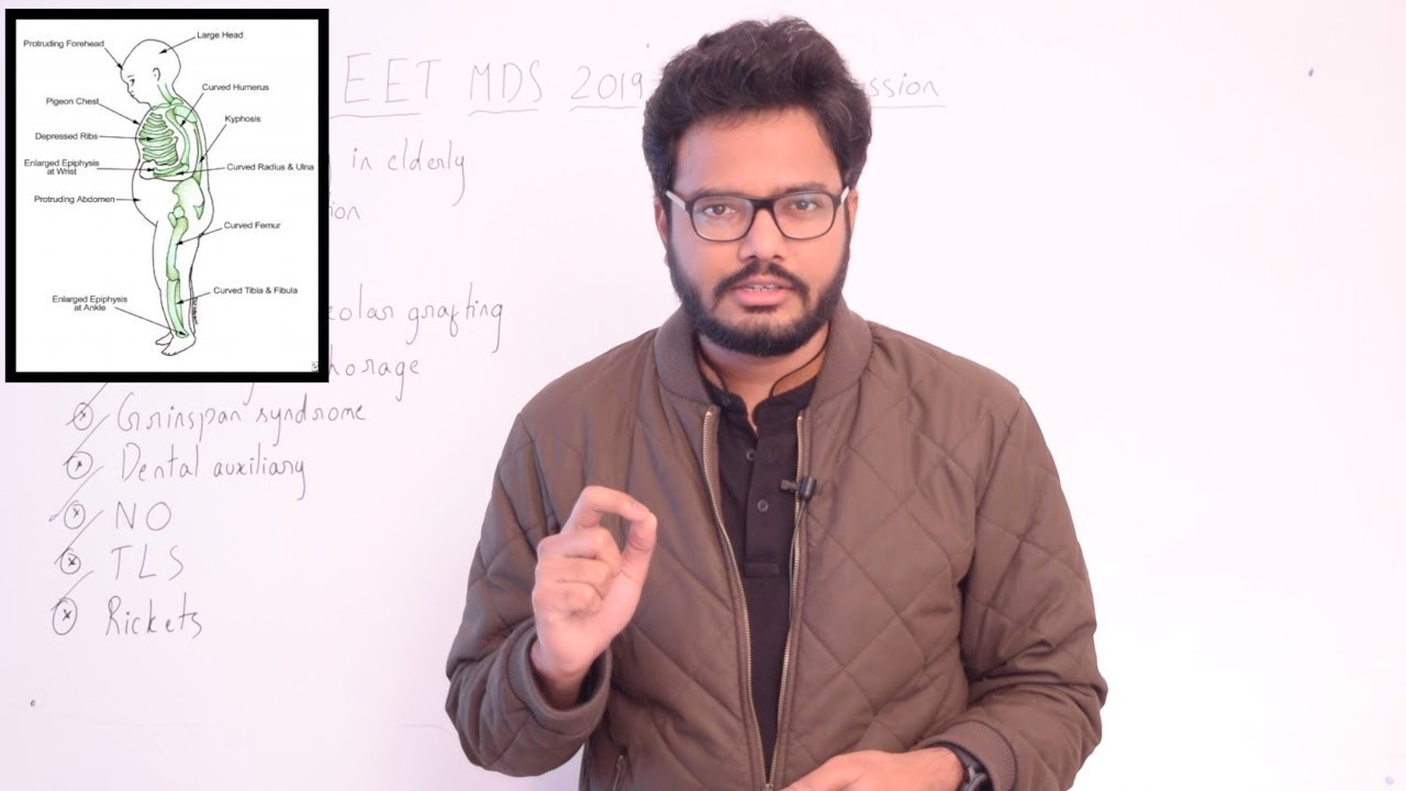 Paper Discussion 16 | NEET MDS 2019