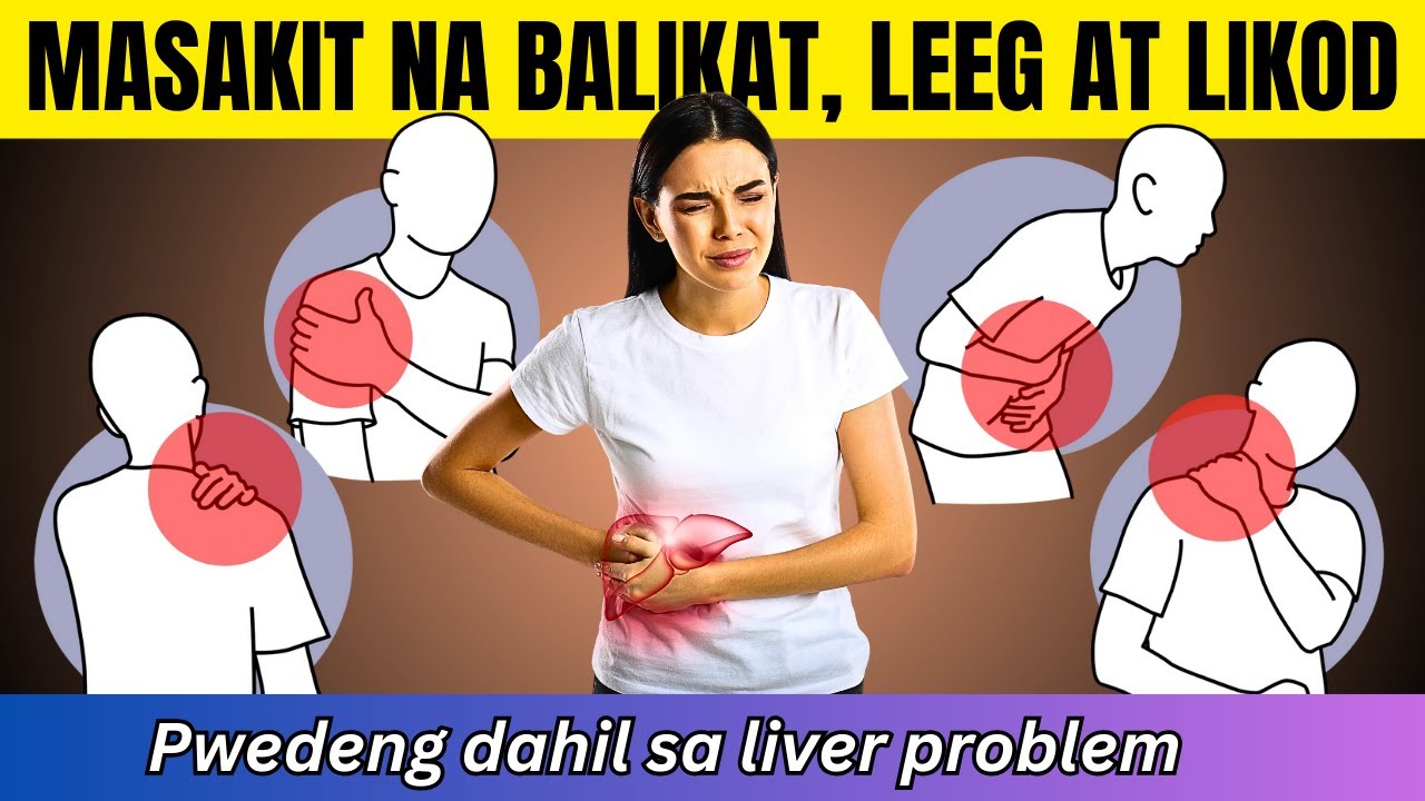 Mga Hindi Pangkaraniwang Sintomas na Ikaw ay Merong Sakit sa Atay | Doc Cherry