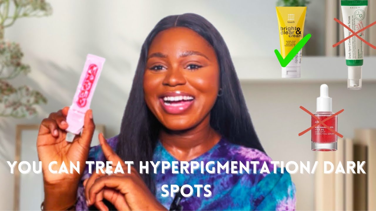 I cleared my hyperpigmentation in few weeks | skincare products that treats hyperpigmentation