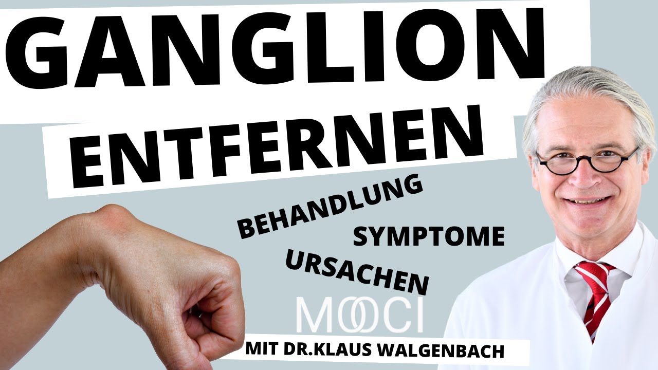Ganglion behandeln! - Ursachen, Symptome, Behandlung