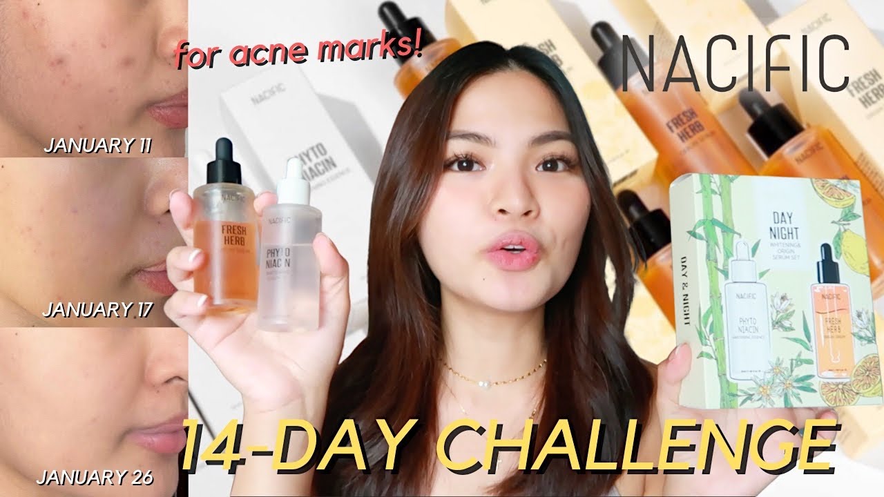 14-DAY CHALLENGE TO FADE DARK SPOTS USING NACIFIC DAY & NIGHT SET! 😱 (With Photos) • Joselle Alandy