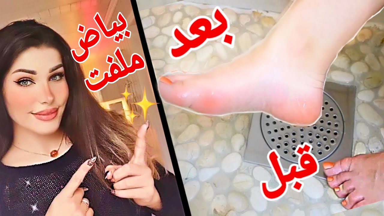 قولي وداعا لتشققات وخشونة القدمين واسمرارها | ترطيب, تنعيم وتوريد فوري | نتيجة فعالة وفورية.