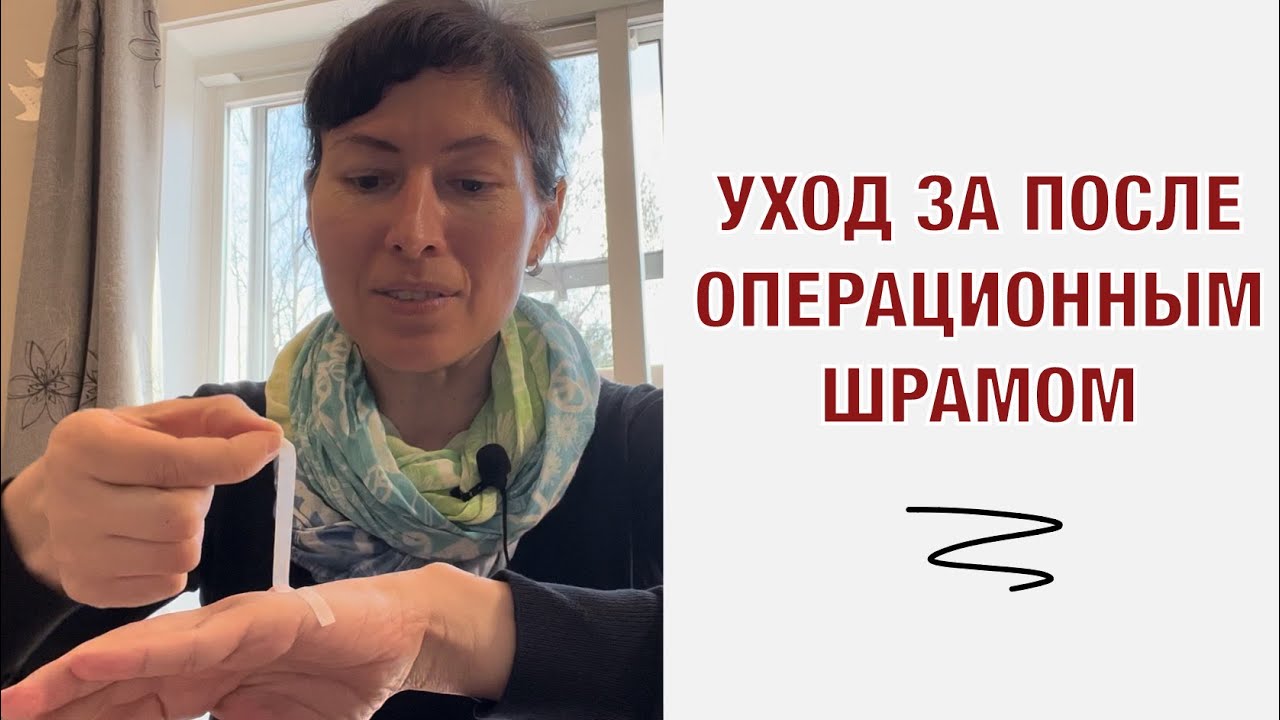 Уход за послеоперационным шрамом.
