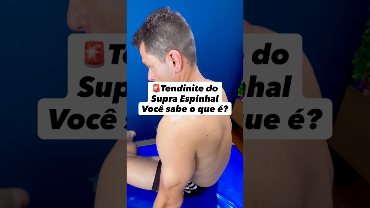 Tendinite do supraespinhal: quando o ombro n&atilde;o colabora 💥