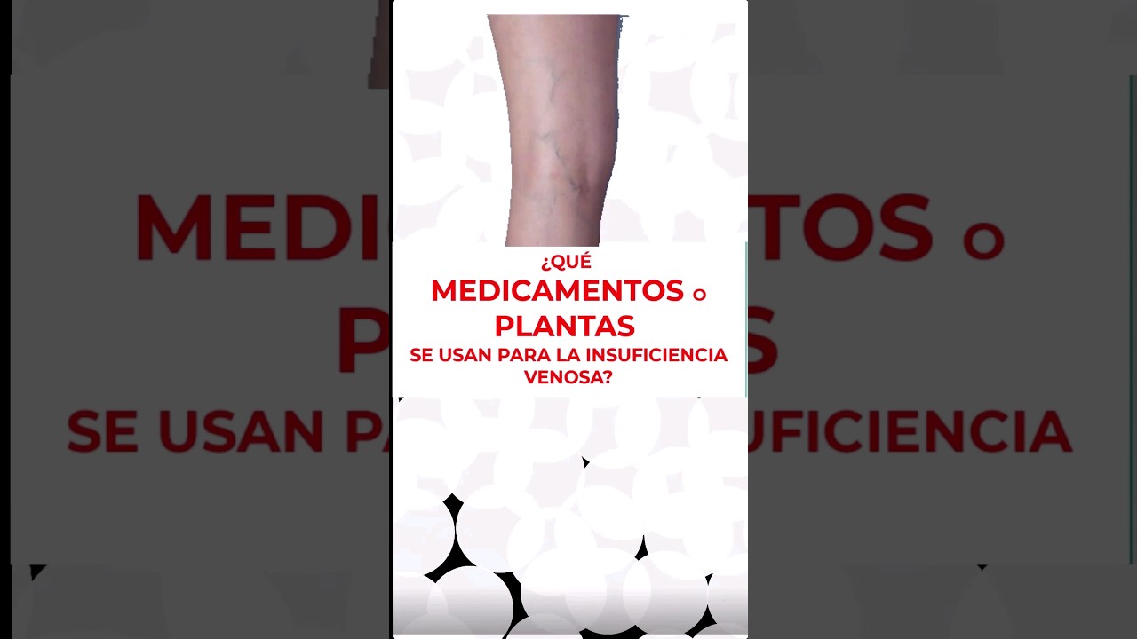 &iquest;Qu&eacute; medicamentos o plantas se usan para las Varices?