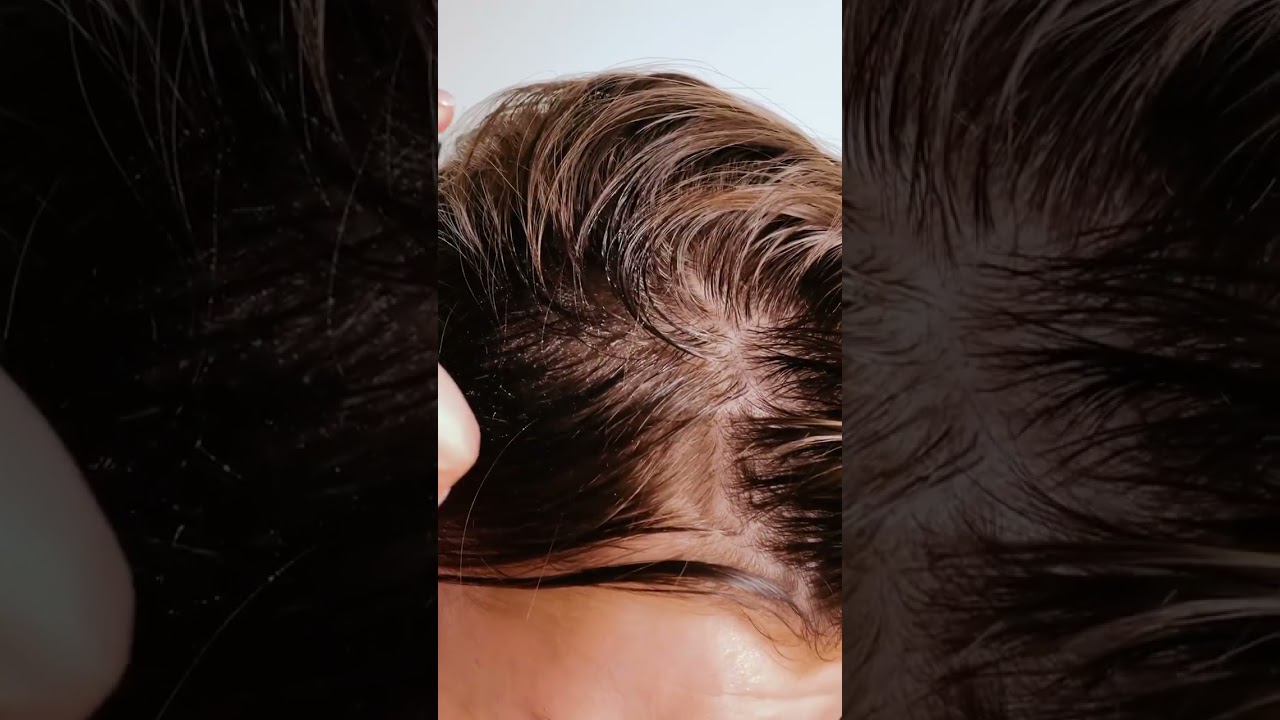 Jak&eacute; benefity m&aacute; podporuj&iacute;c&iacute; sprej HAIR BOOSTER?