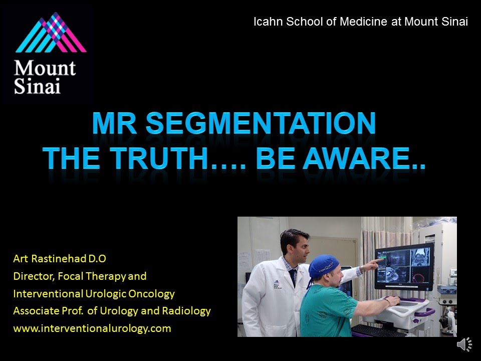 5. MR Segmentation Dyancad 3 3