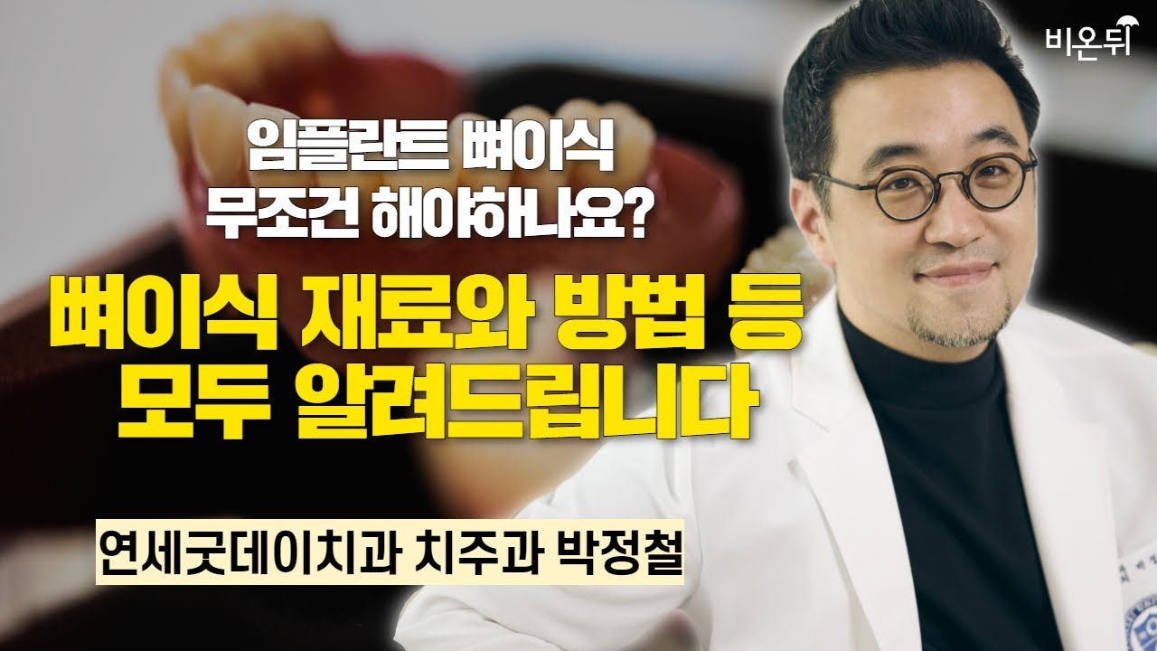 임플란트 뼈이식 무조건 해야하나요? 뼈이식 재료와 방법등 모두 알려드립니다 / 연세굿데이치과 치주과 박정철