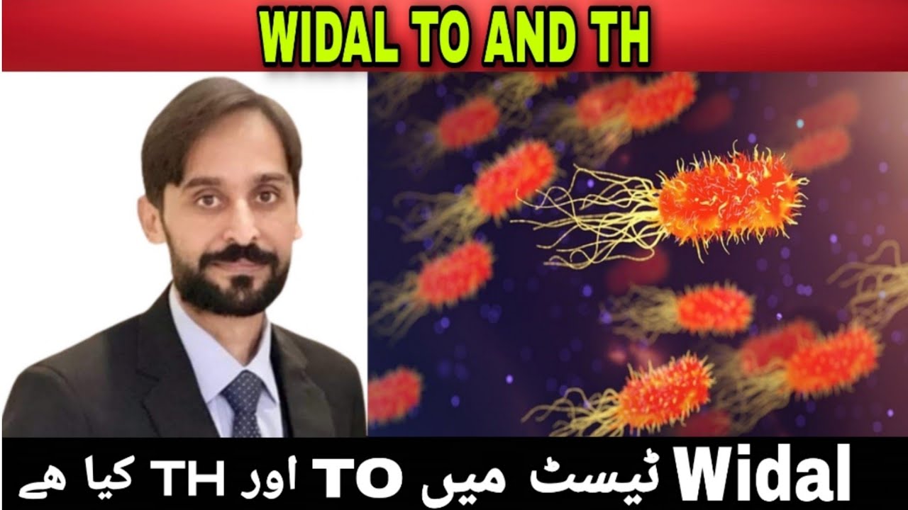 What is TO and TH in Widal Test