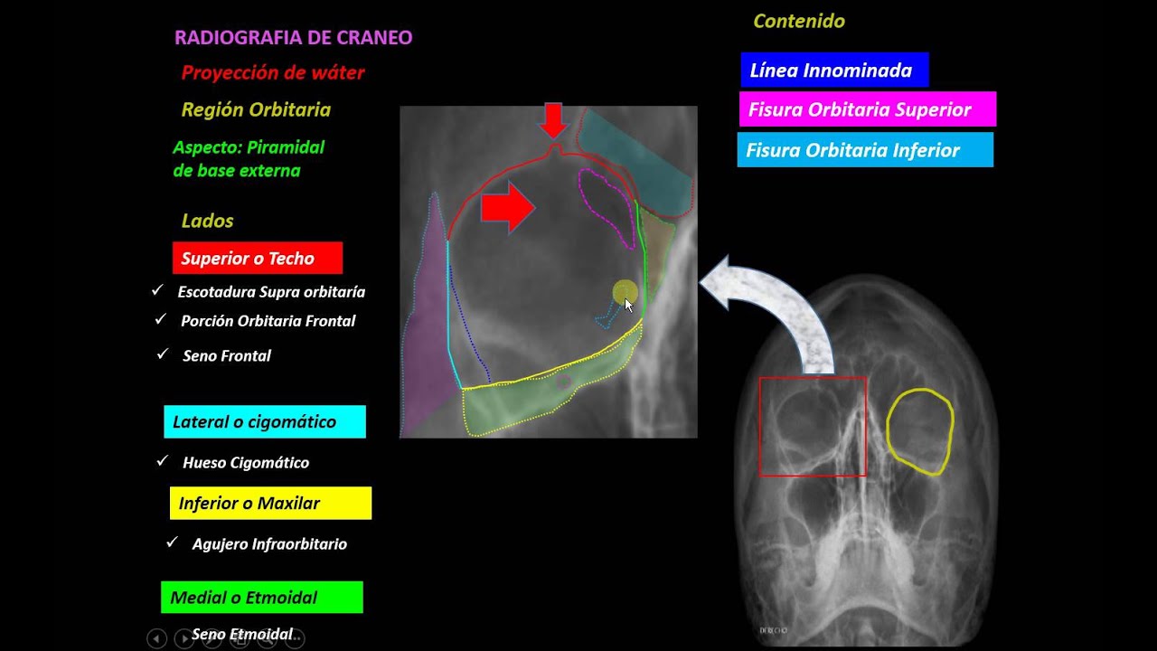 RADIOLOGIA REGIONES CARA