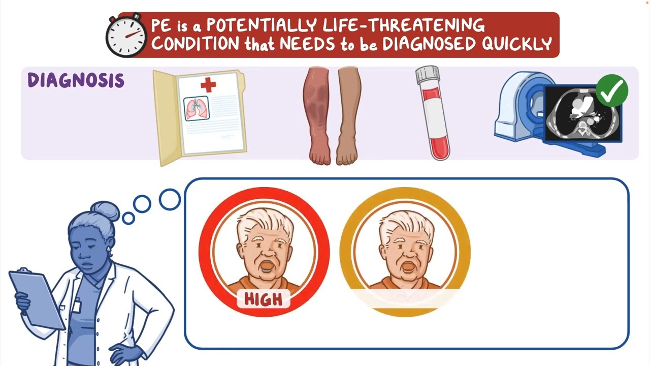 MyEMCert Key Advance | Outpatient Treatment for Pulmonary Embolism