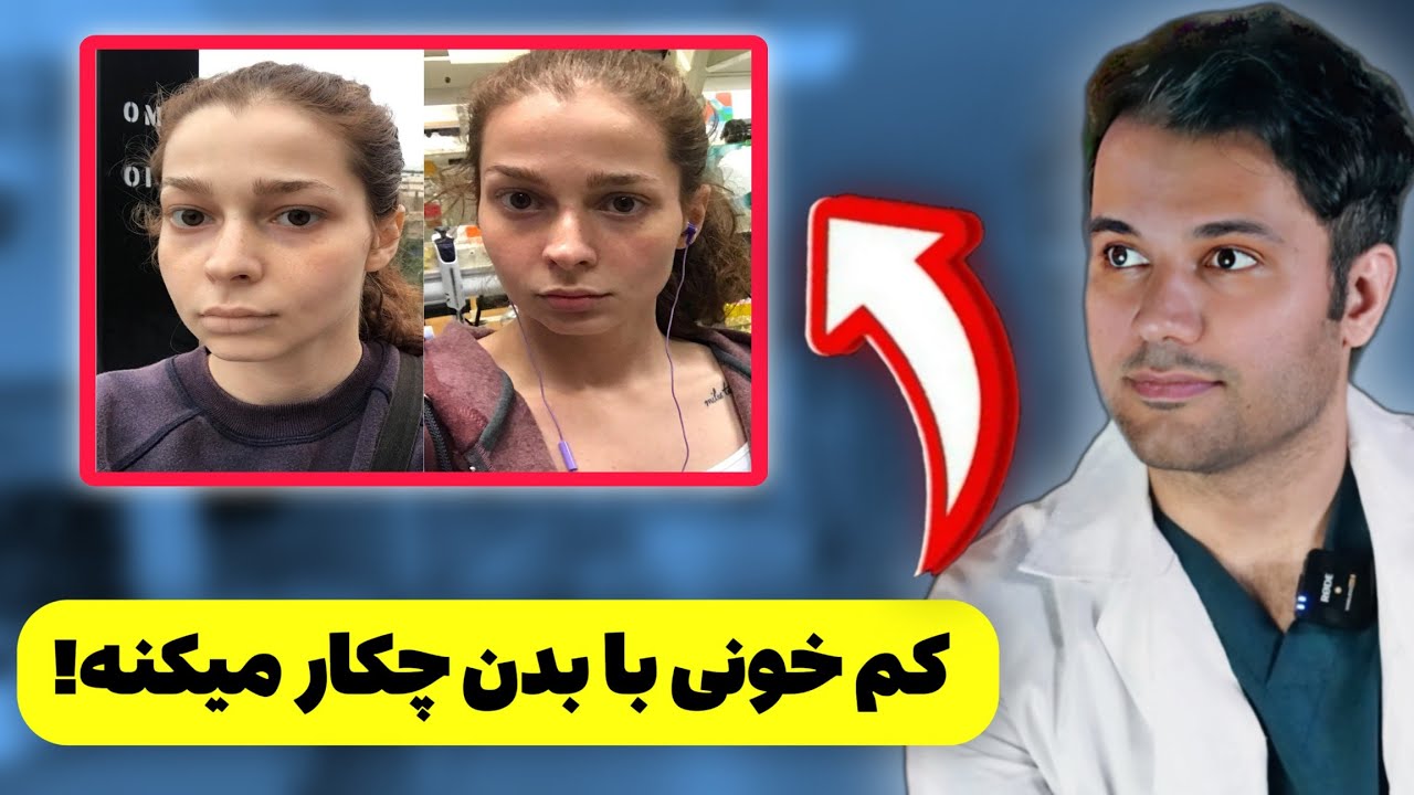 علایم کم خونی فقر آهن |  درمان کم خونی | پیشگیری