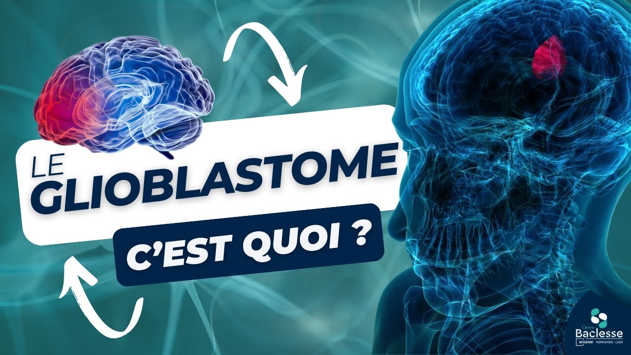 Le glioblastome, c'est quoi ? - Journée internationale de la sensibilisation aux tumeurs cérébrales