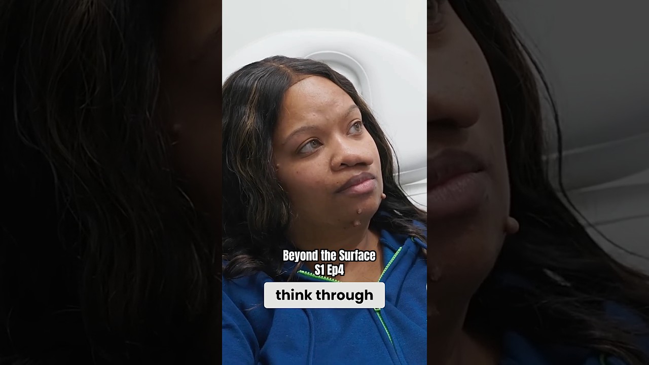 LIFE CHANGING TUMOR REMOVAL - Watch Beyond the Surface