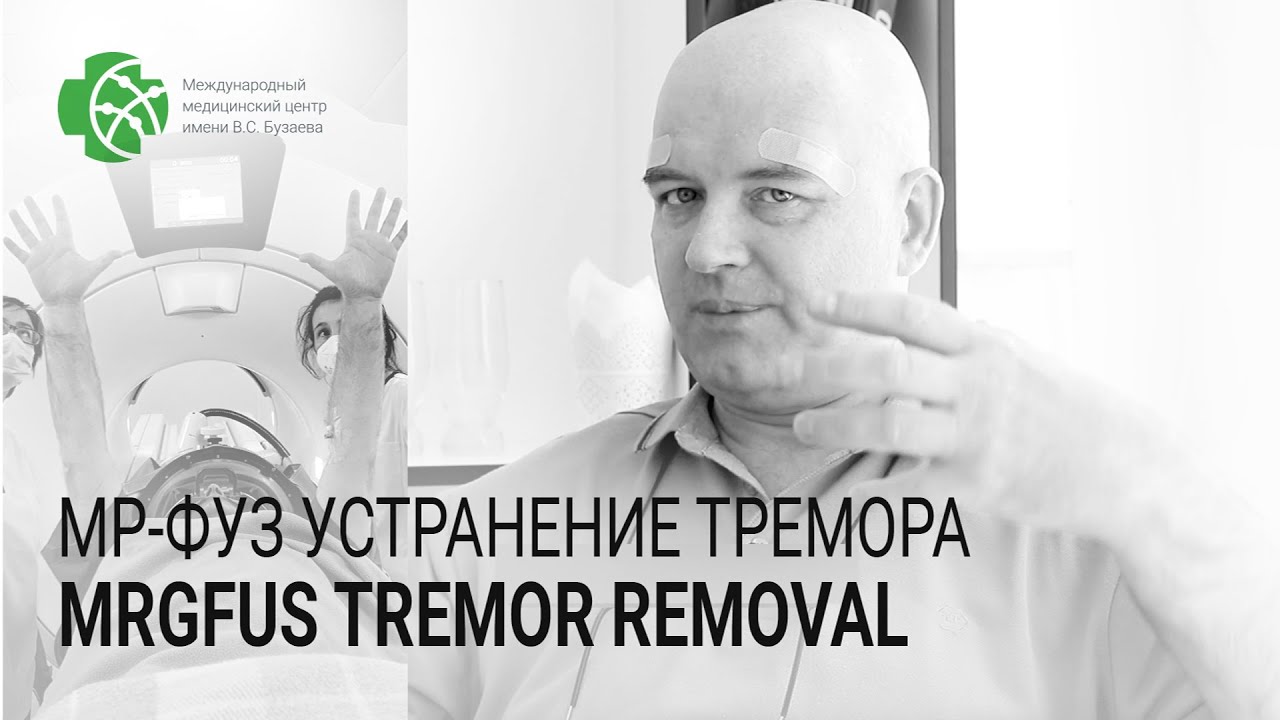 Результаты МР-ФУЗ устранения тремора в ММЦ им. В.С. Бузаева