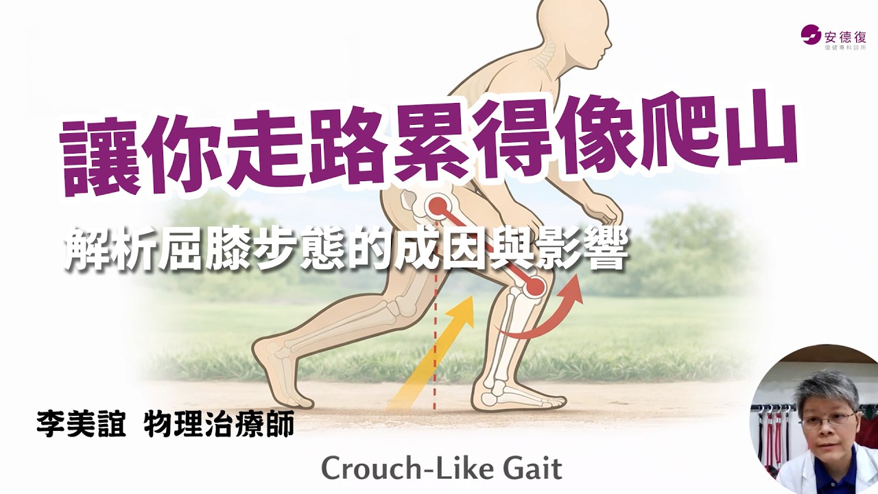 腦中風步態｜解析「屈膝步態」，為什麼走平地像爬山一樣累？