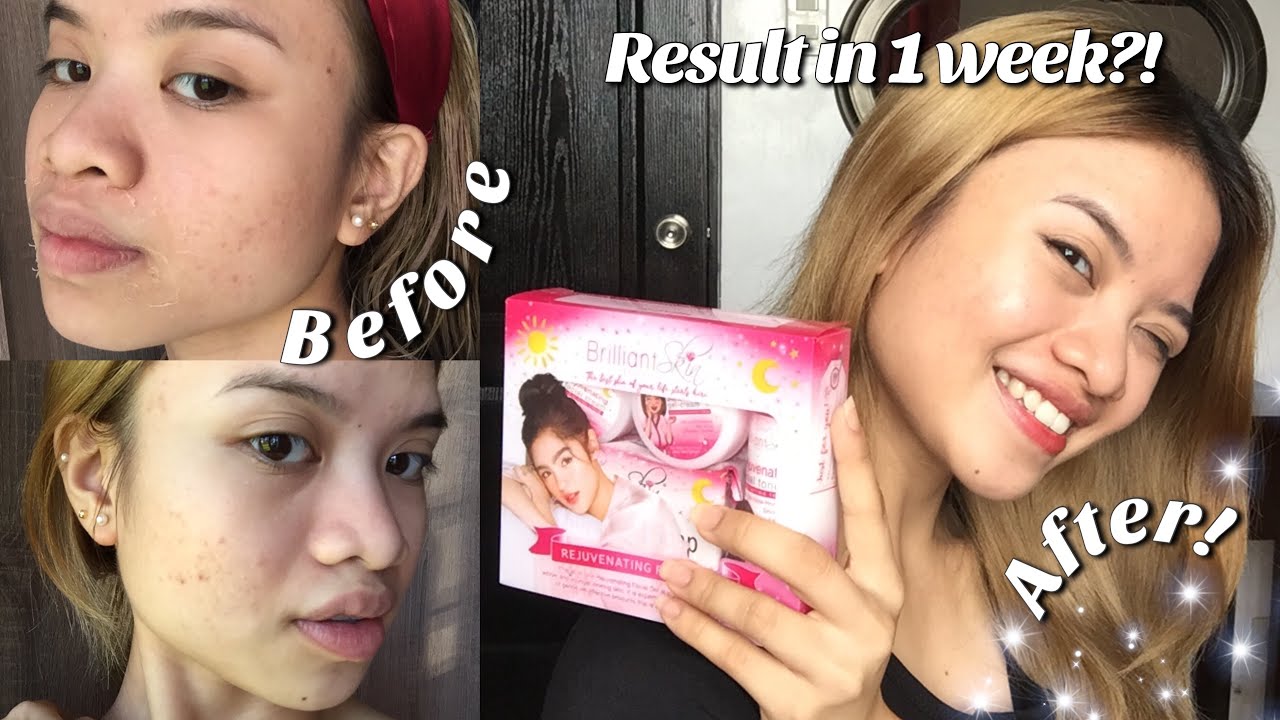 BRILLIANT SKIN REJUVENATING SET (1 WEEK HONEST REVIEW) ✨