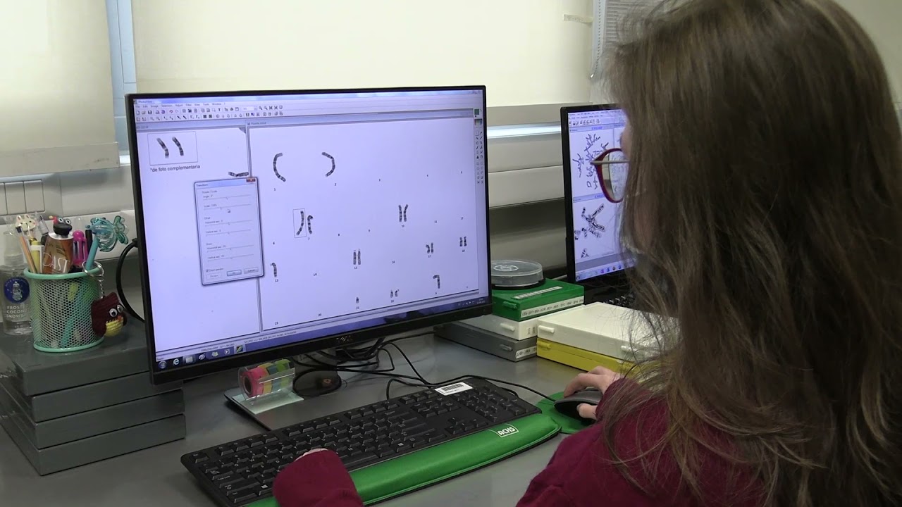 DÍA DEL TECNÓLOGO MÉDICO HRA - ANATOMÍA PATOLÓGICA