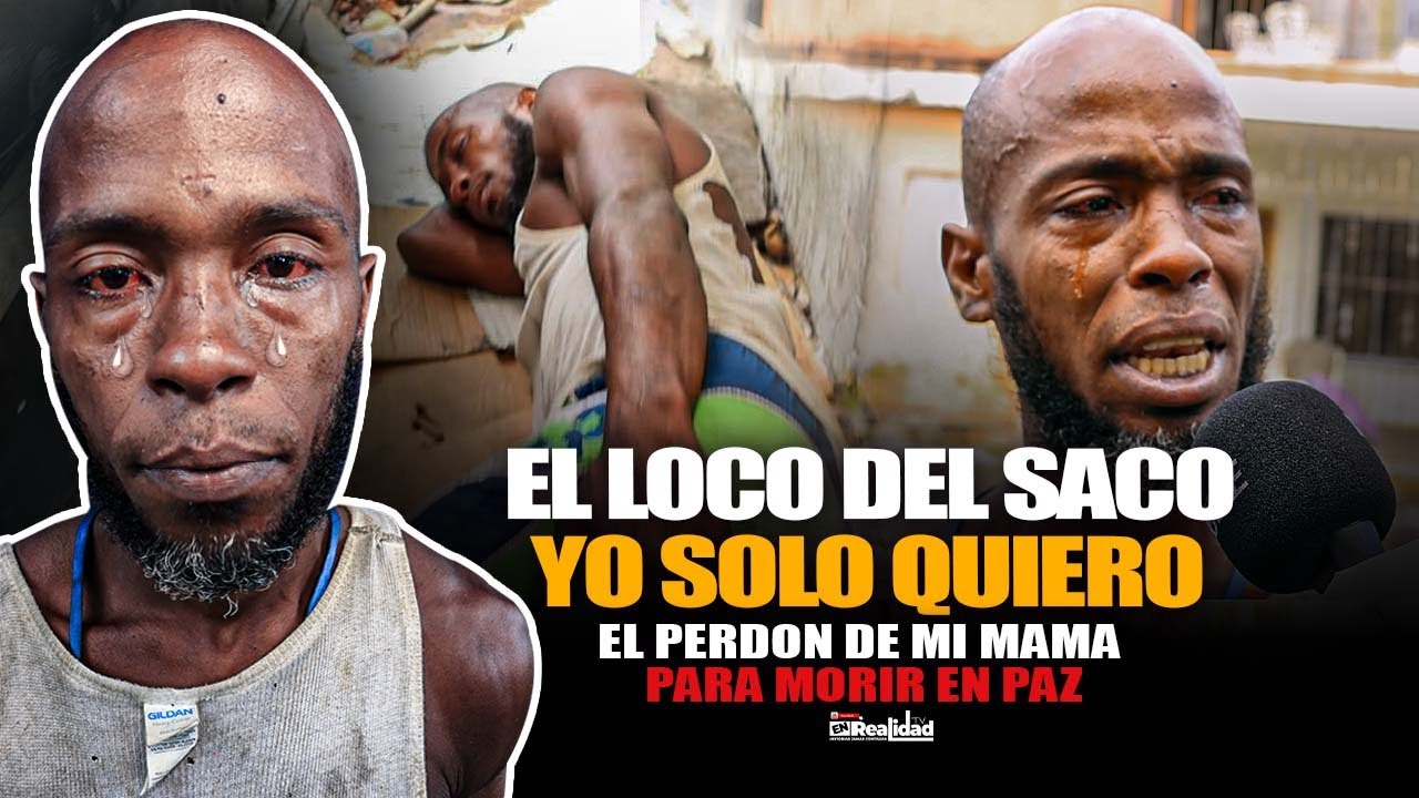💥EL LOCO DEL SACO💥LA MANO SE ME DOBLO DESDE QUE LE PEGUE A MI MADRE😭 @edgarjesustv