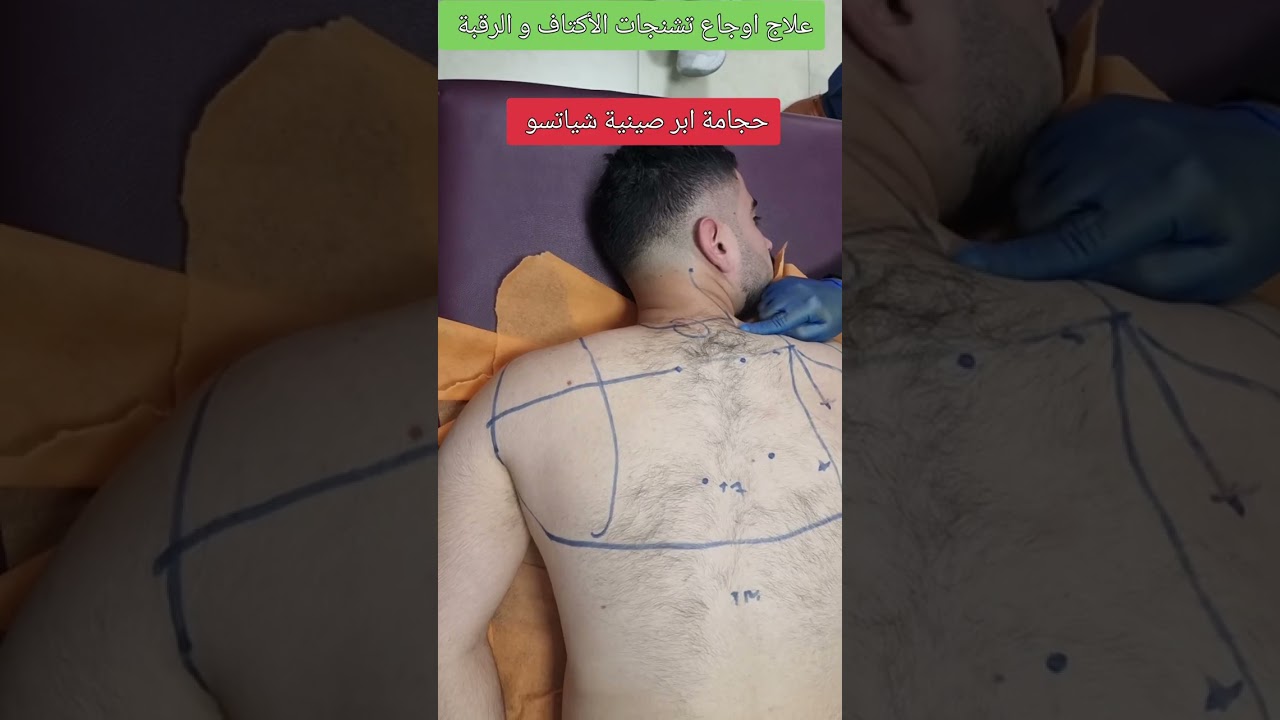 علاج تشنجات العضلات والأكتاف واوجاع الشقيقة.