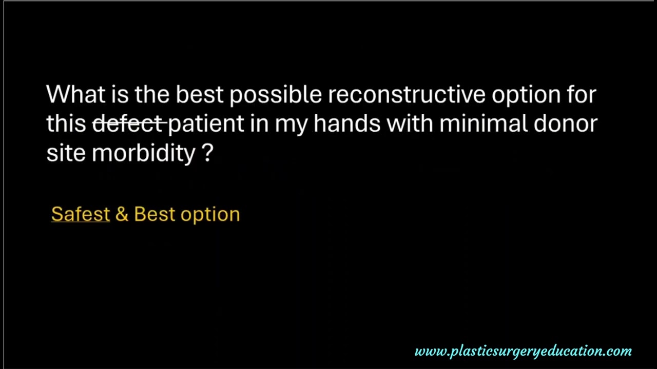 4 Questions to decide flap of choice for lower limb defects!