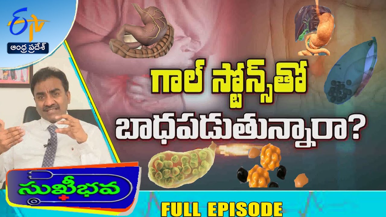 About Gall Stones  | Sukhibhava | 28th January 2024 | Full Episode | ETV AP