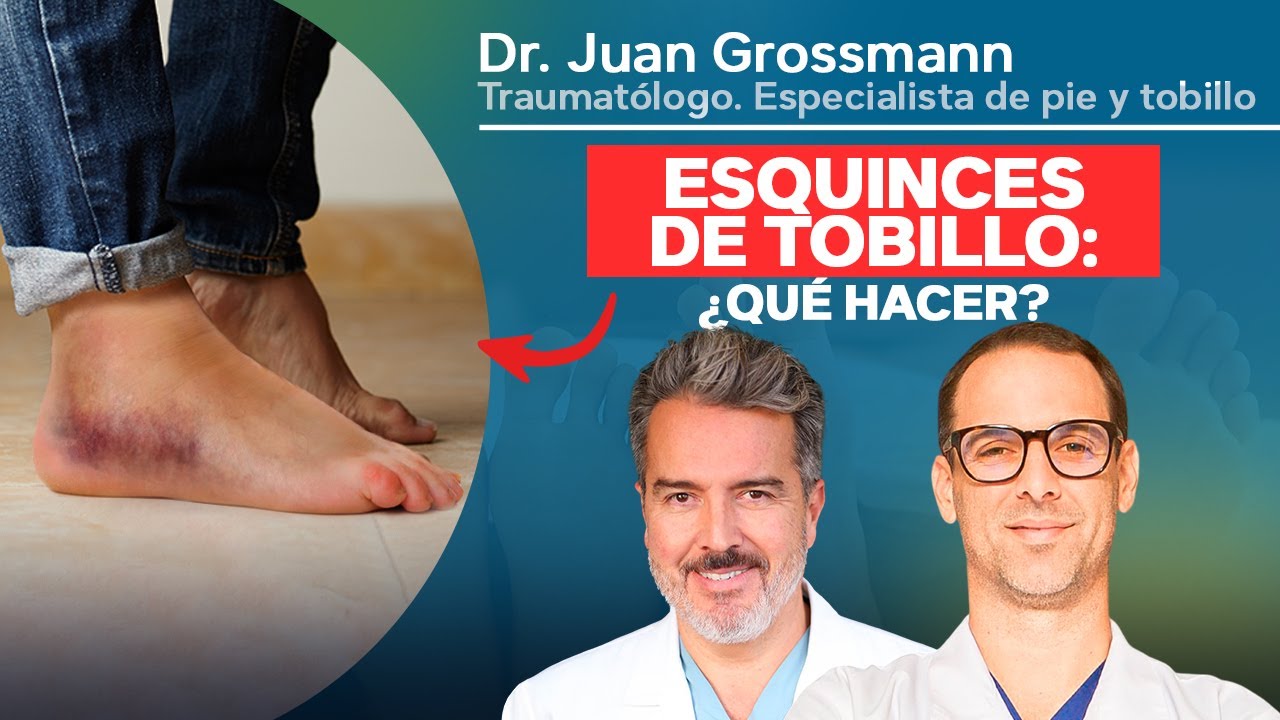 Esguinces de tobillo: qué hacer. #Esquinces #PieyTobillo #traumatología #Traumatólogo