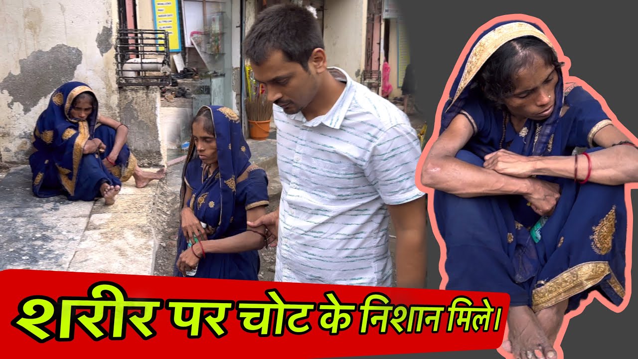 शरीर पर चोट के निशान मिले | Help Drive Foundation | Tarun mishra | Help | Seva |
