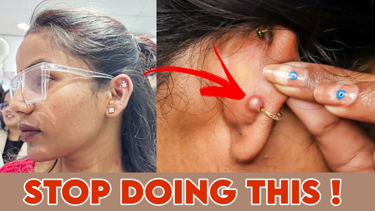 STOP getting Ear/Nose  Piercing Infection Again | 100% Result | Ravinaa Gupta