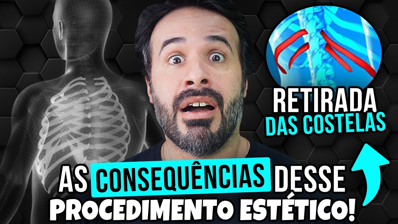 RETIRADA DAS COSTELAS AS CONSEQUÊNCIAS DESSE PROCEDIMENTO ESTÉTICO!