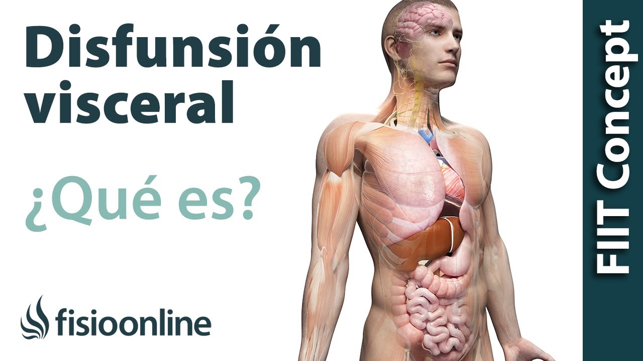 &iquest;Qu&eacute; es una disfunci&oacute;n visceral?